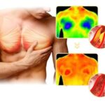 Chest Fat Bee Venom Gynecomastia Heating Oil