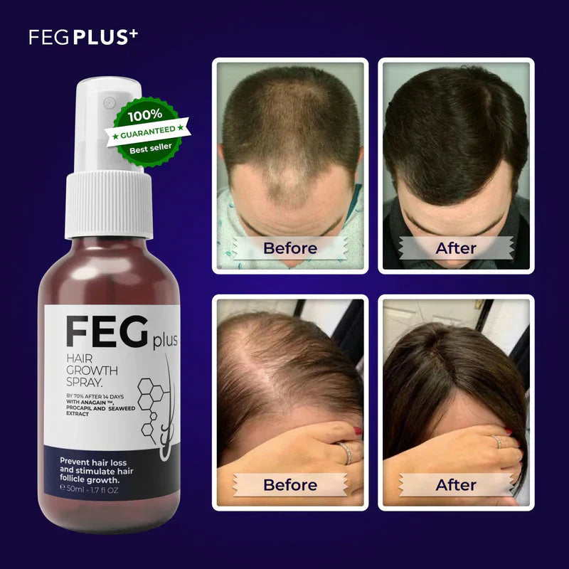 FEG Plus Hair Growth Spray Original