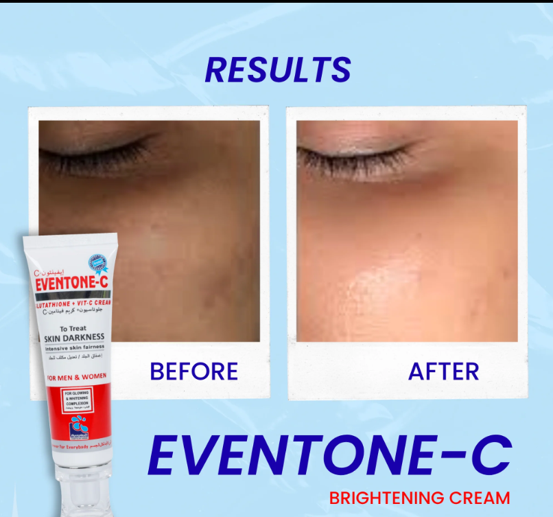 Eventone-C Cream ( Skin whitening ) Original